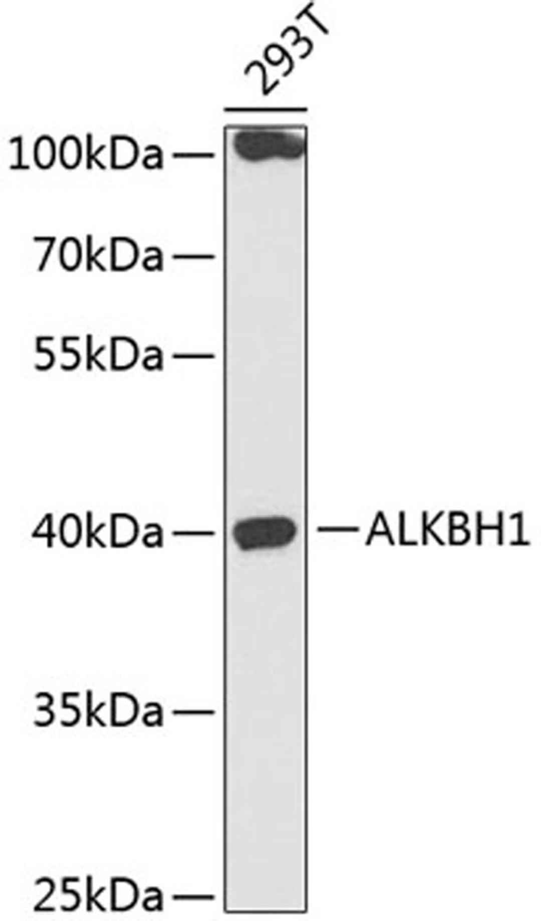 Western blot - ALKBH1 antibody (A14079)