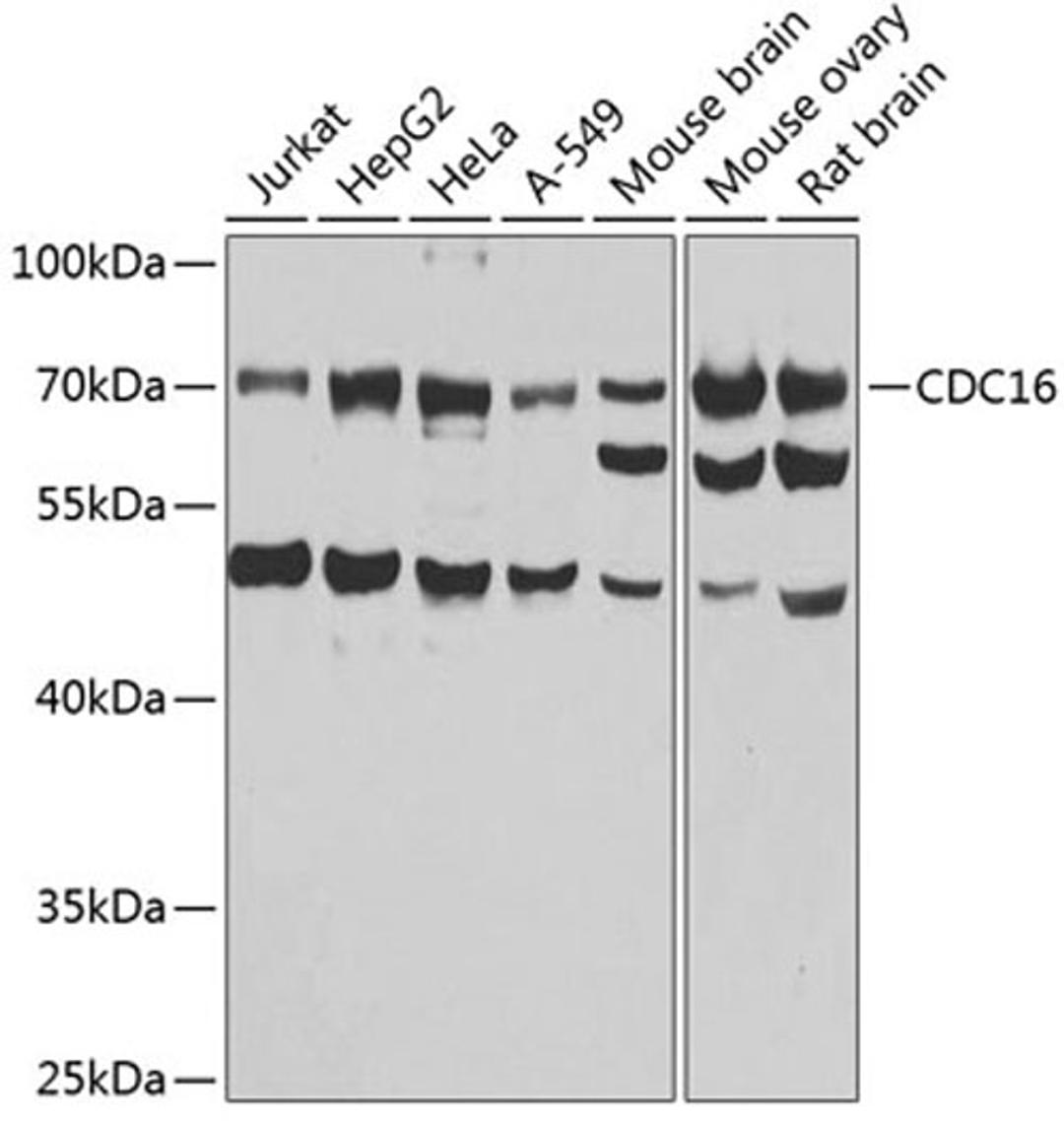 Western blot - CDC16 antibody (A7197)