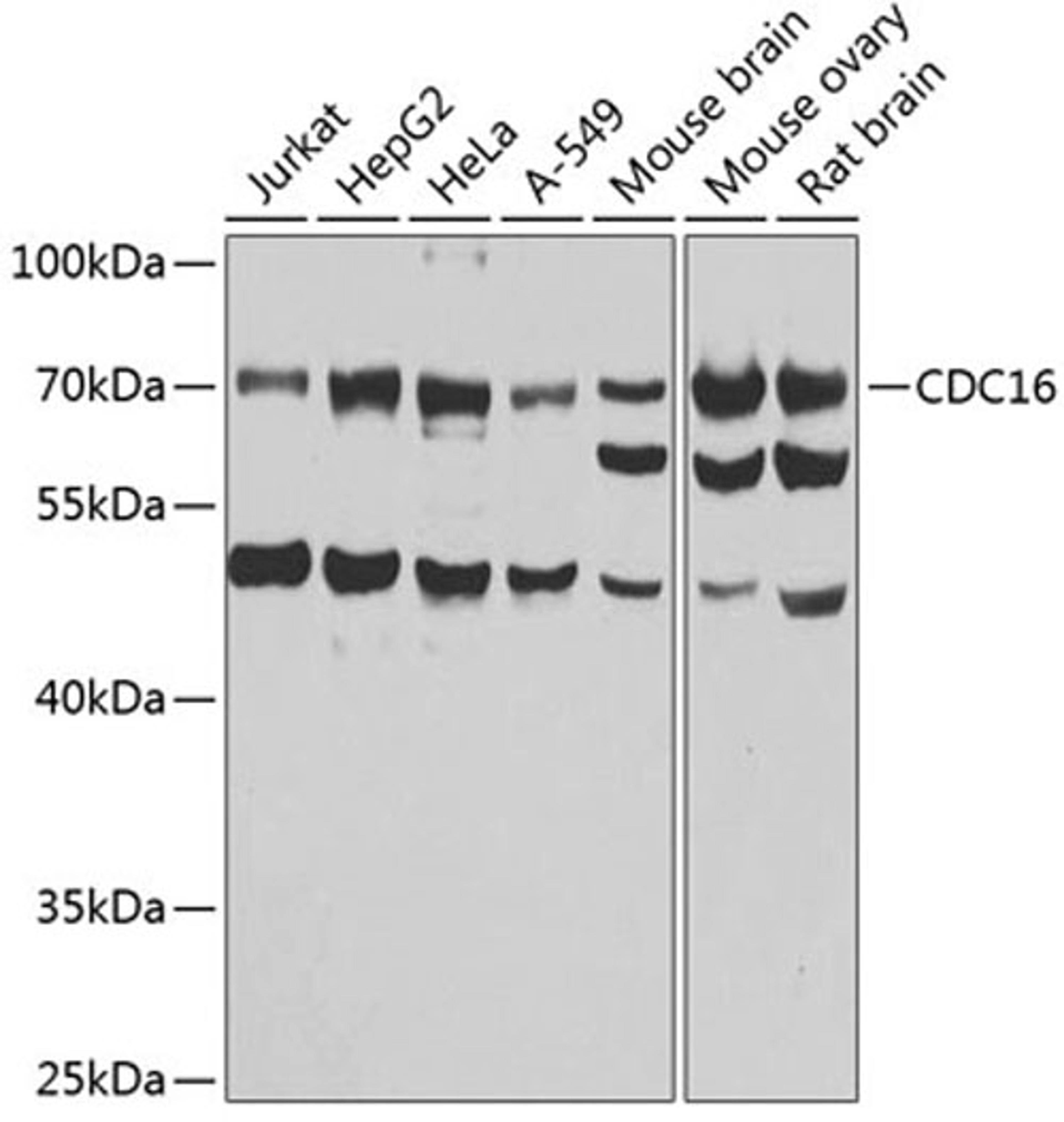 Western blot - CDC16 antibody (A7197)