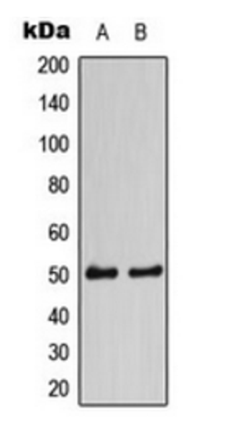 Western blot analysis of HEK293A (Lane 1), NIH3T3 (Lane 2) whole cell lysates using CaMK2 alpha/delta antibody