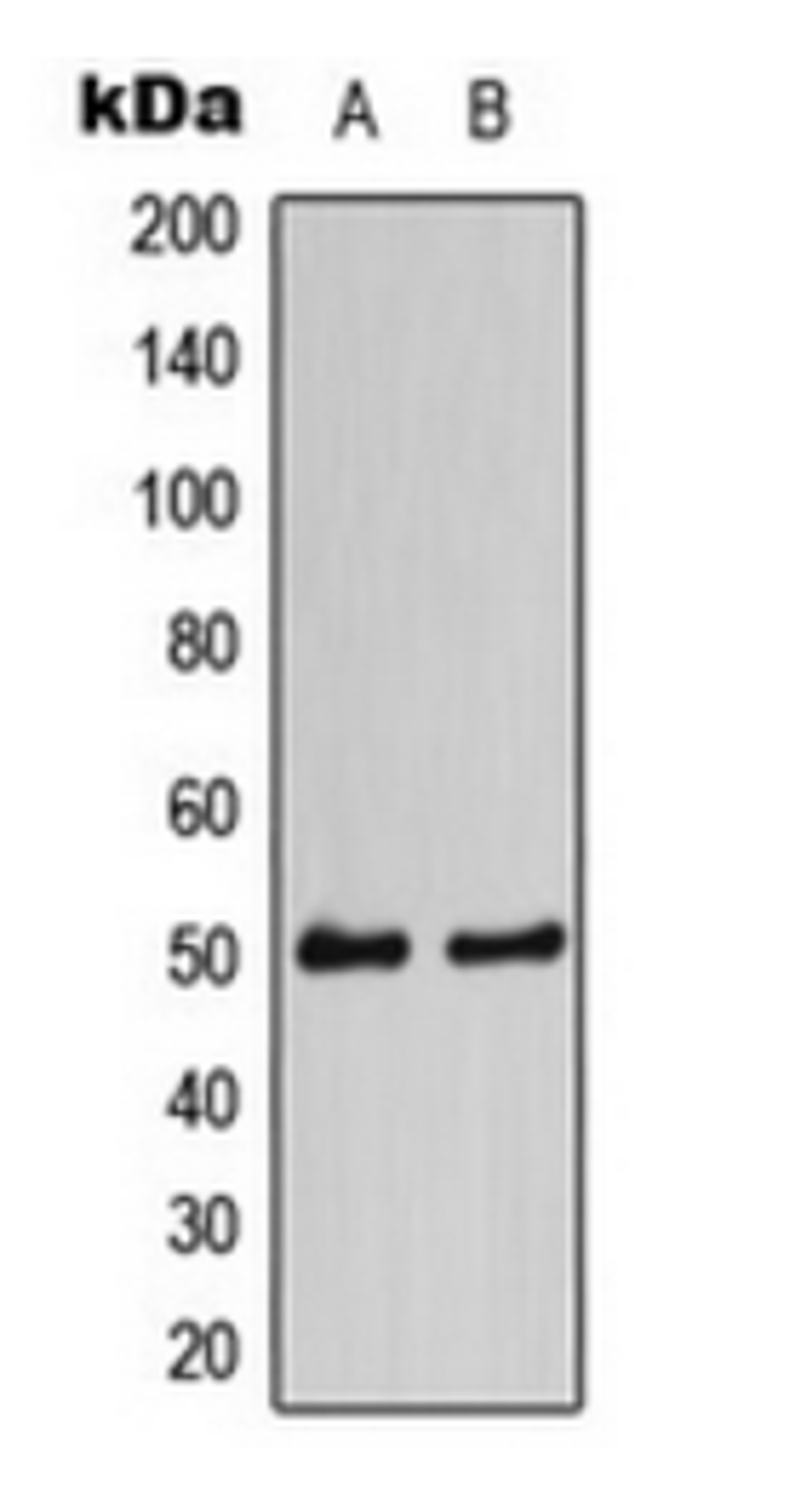 Western blot analysis of HEK293A (Lane 1), NIH3T3 (Lane 2) whole cell lysates using CaMK2 alpha/delta antibody