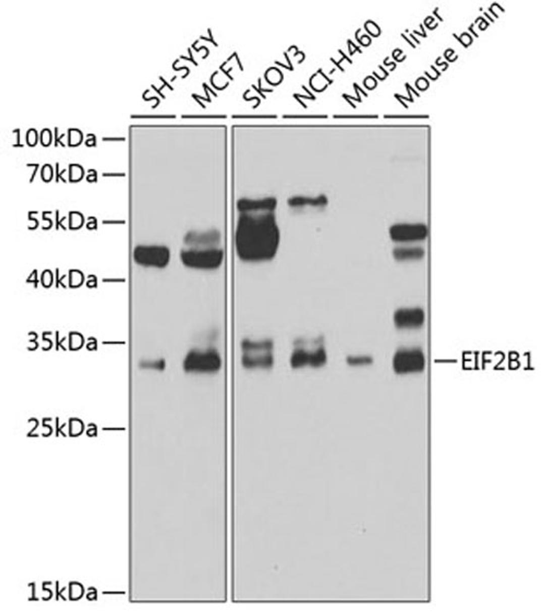 Western blot - EIF2B1 antibody (A7892)