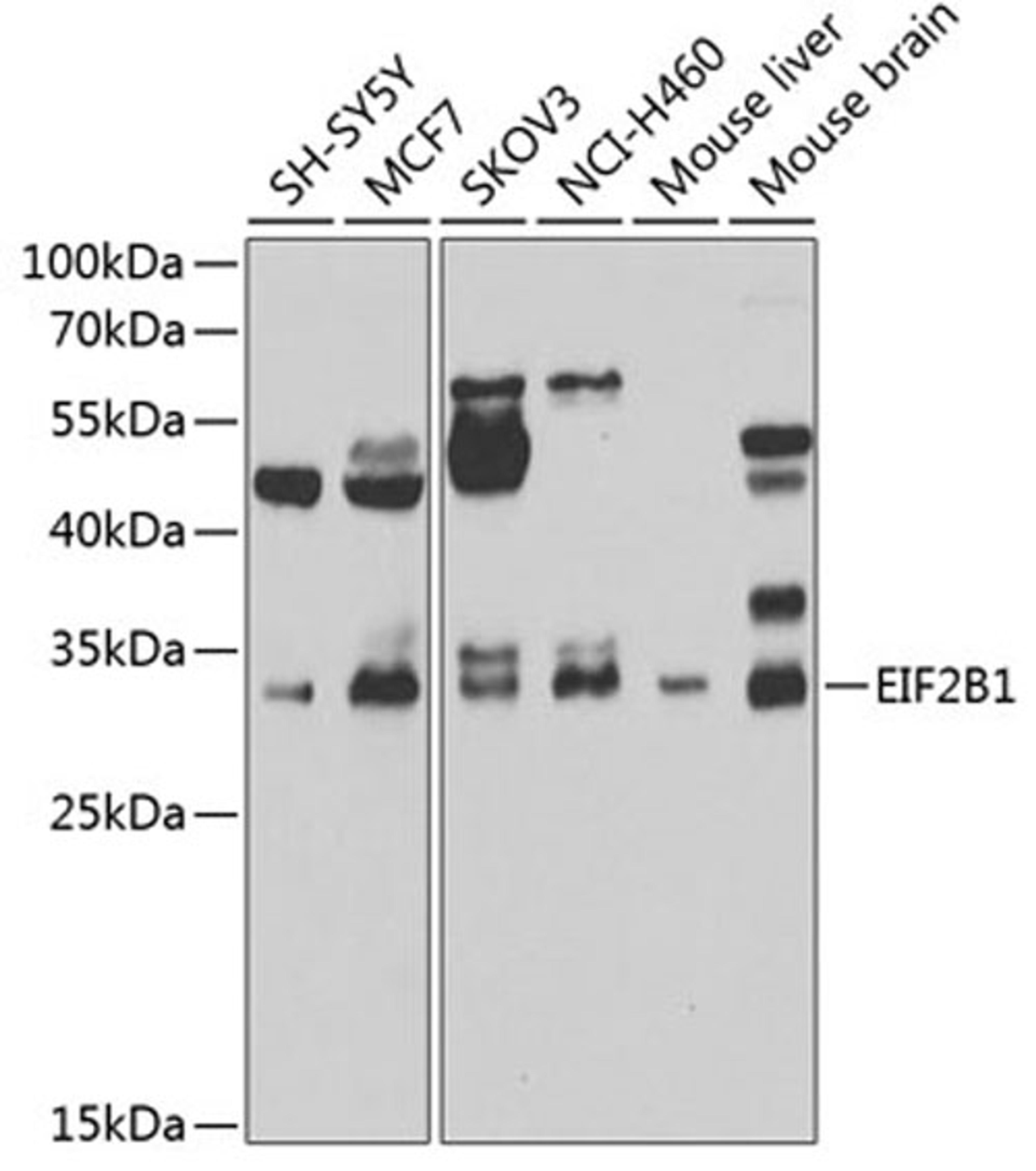 Western blot - EIF2B1 antibody (A7892)