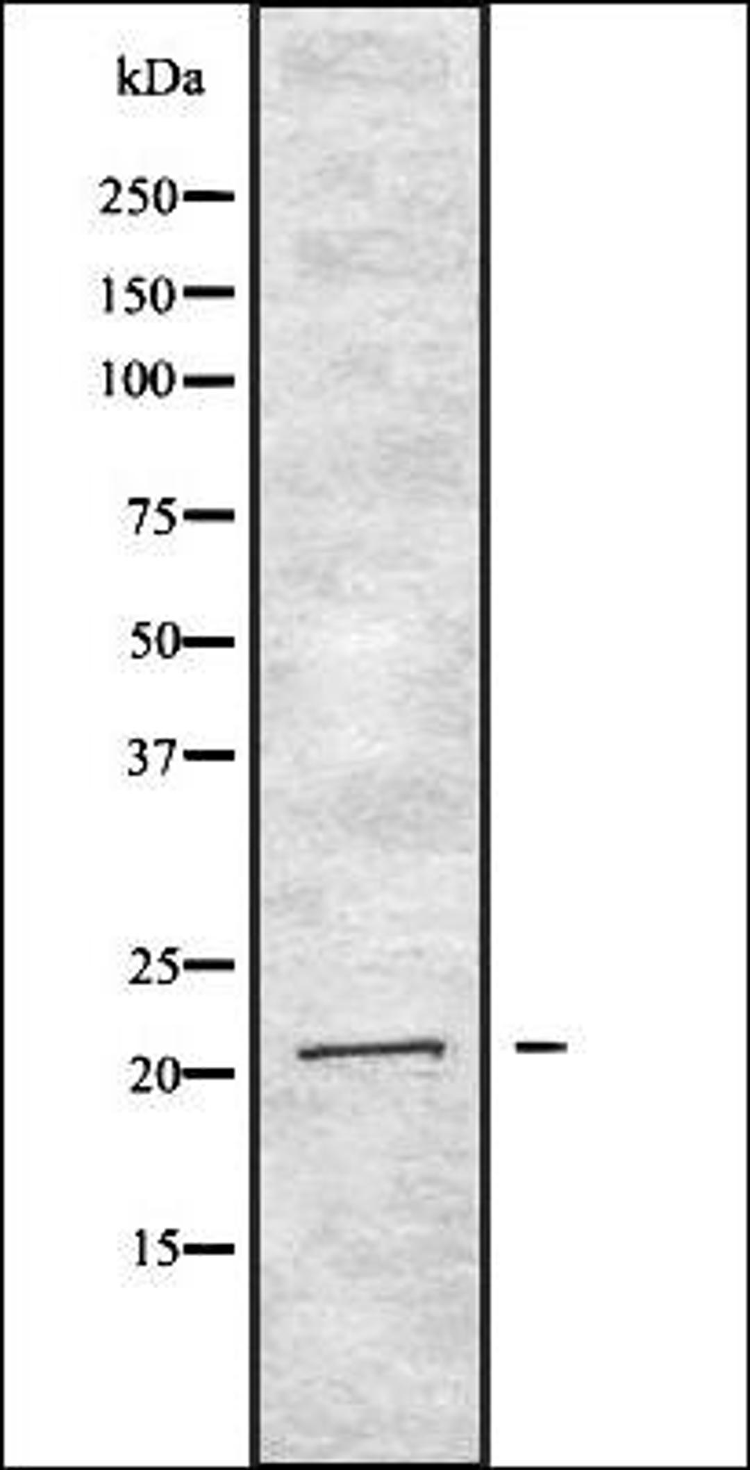 Western blot analysis of HEK293 cells using IFNA2 antibody