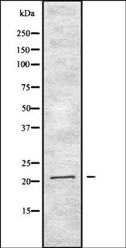 Western blot analysis of HEK293 cells using IFNA2 antibody