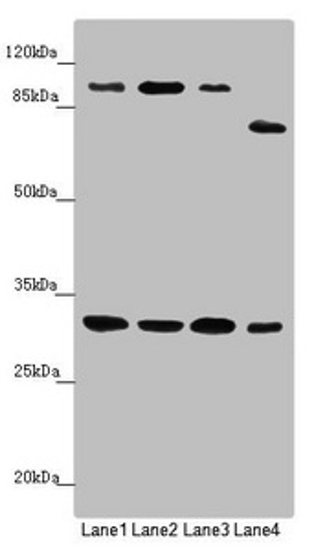 Western blot. All lanes: MTIF3 antibody at 1.15 ug/ml. Lane 1: Mouse small intestine tissue. Lane 2: Rat heart tissue. Lane 3: Mouse liver tissue. Lane 4: Hela whole cell lysate. Secondary. Goat polyclonal to rabbit IgG at 1/10000 dilution. Predicted band size: 32 kDa. Observed band size: 32, 100, 75 kDa.