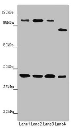 Western blot. All lanes: MTIF3 antibody at 1.15 ug/ml. Lane 1: Mouse small intestine tissue. Lane 2: Rat heart tissue. Lane 3: Mouse liver tissue. Lane 4: Hela whole cell lysate. Secondary. Goat polyclonal to rabbit IgG at 1/10000 dilution. Predicted band size: 32 kDa. Observed band size: 32, 100, 75 kDa.