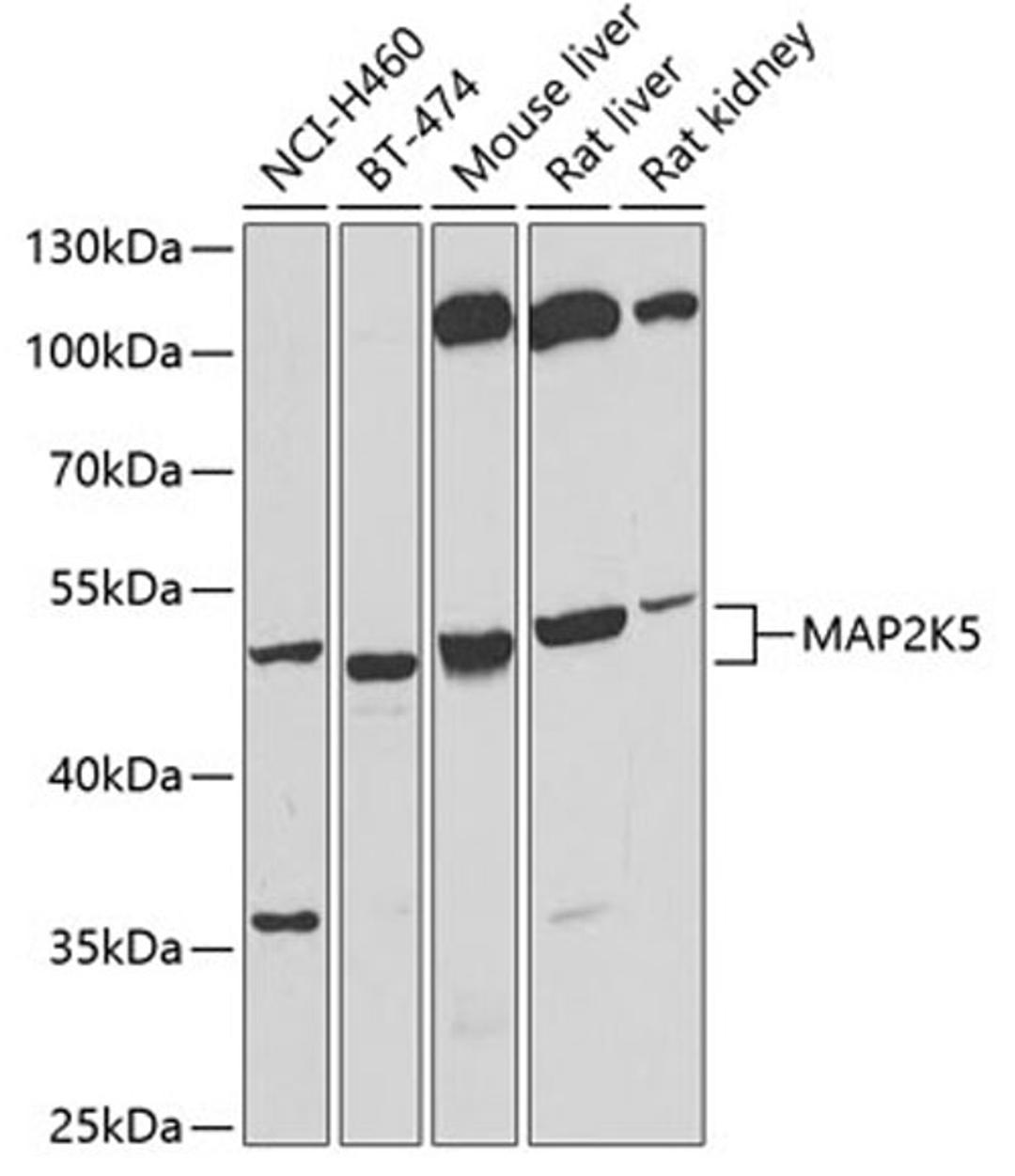 Western blot - MAP2K5 antibody (A6953)