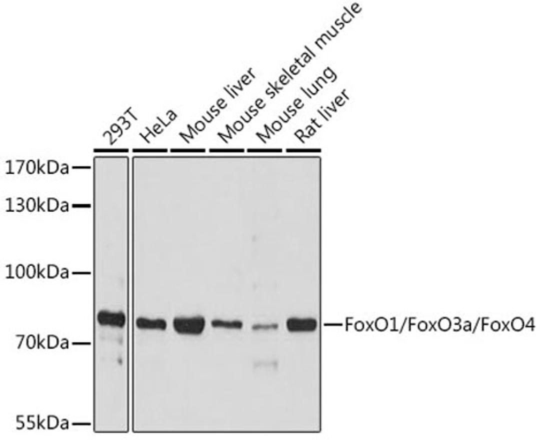 Western blot - FoxO1/FoxO3a/FoxO4 antibody (A17978)