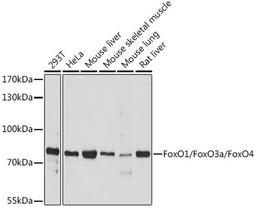 Western blot - FoxO1/FoxO3a/FoxO4 antibody (A17978)