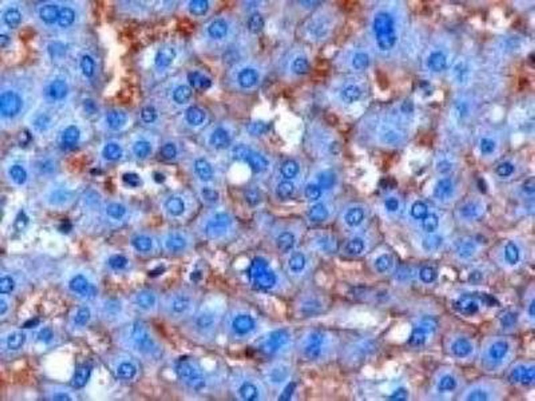 Immunohistochemistry-Paraffin: ENPP-1 Antibody [NBP2-27561] - Staining of paraffin embedded Human Liver. Microwaved antigen retrieval with citrate buffer pH 6, HRP-staining.