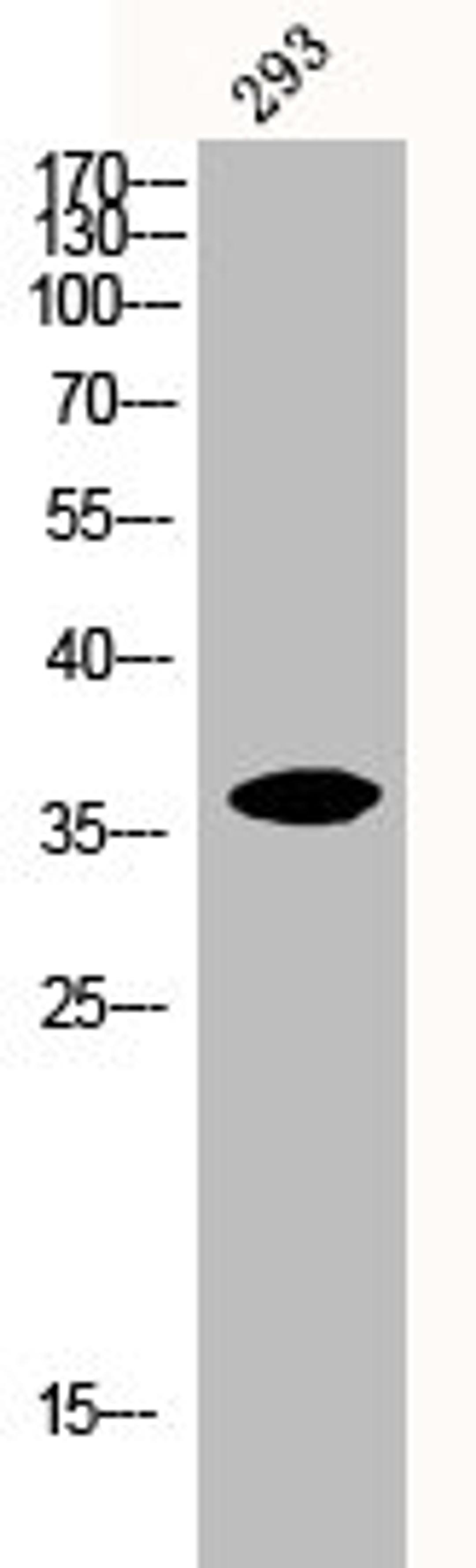 Western Blot analysis of 293 cells using Iκ;B-α Polyclonal Antibody