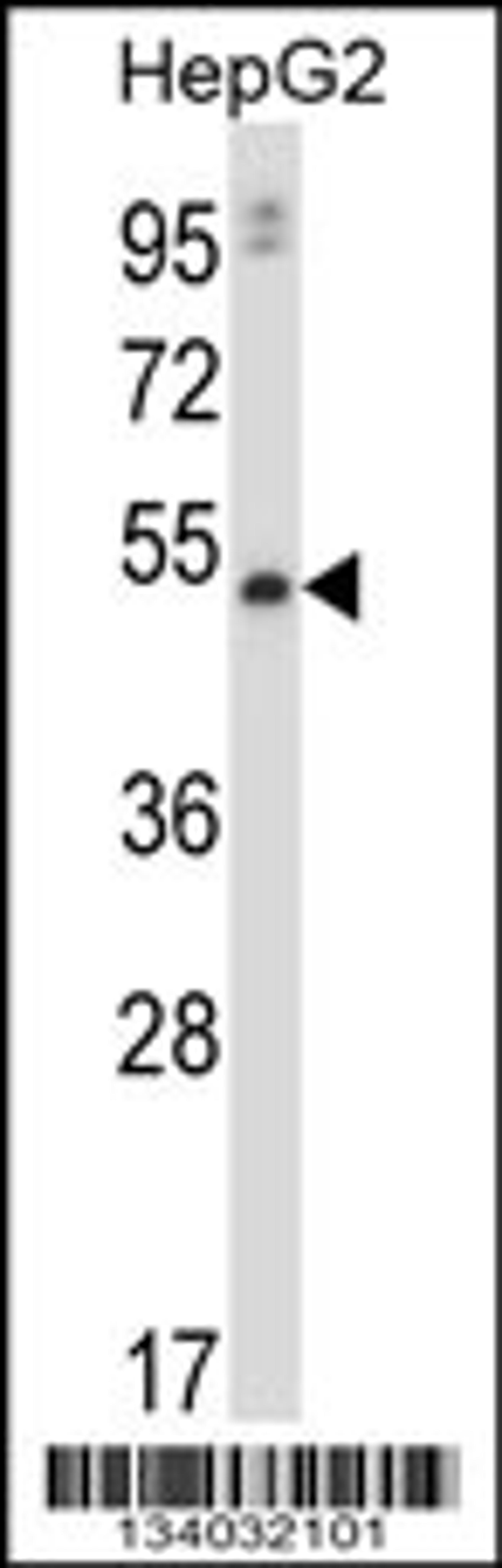 Western blot analysis in HepG2 cell line lysates (35ug/lane).