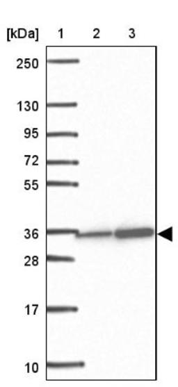 Western Blot: TFIIB Antibody [NBP2-34143] - Lane 1: Marker [kDa] 250, 130, 95, 72, 55, 36, 28, 17, 10<br/>Lane 2: Human cell line RT-4<br/>Lane 3: Human cell line U-251MG sp