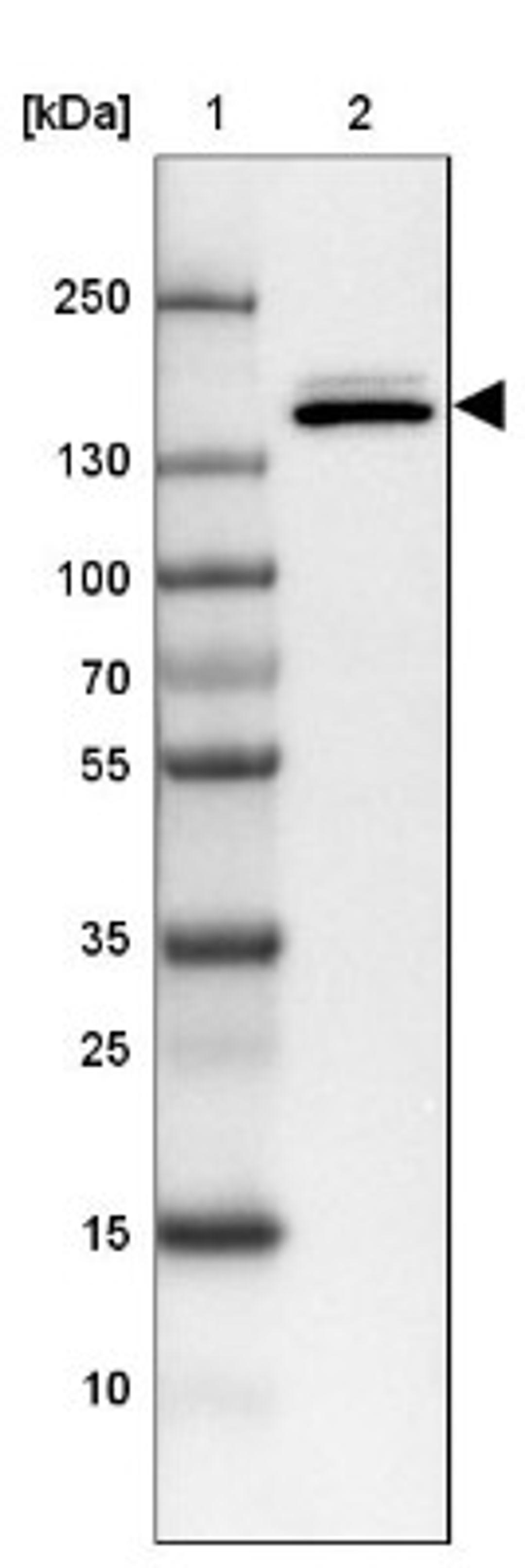 Western Blot: SynGAP Antibody [NBP2-34046] - Lane 1: Marker [kDa] 250, 130, 100, 70, 55, 35, 25, 15, 10<br/>Lane 2: Tonsil