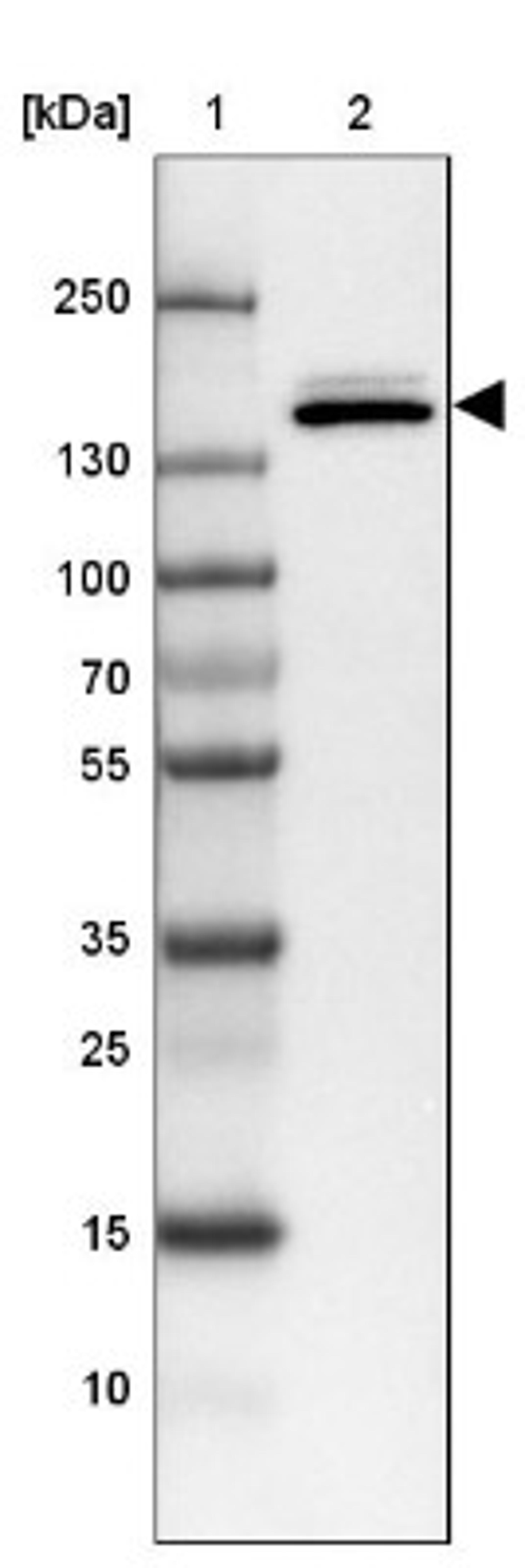 Western Blot: SynGAP Antibody [NBP2-34046] - Lane 1: Marker [kDa] 250, 130, 100, 70, 55, 35, 25, 15, 10<br/>Lane 2: Tonsil