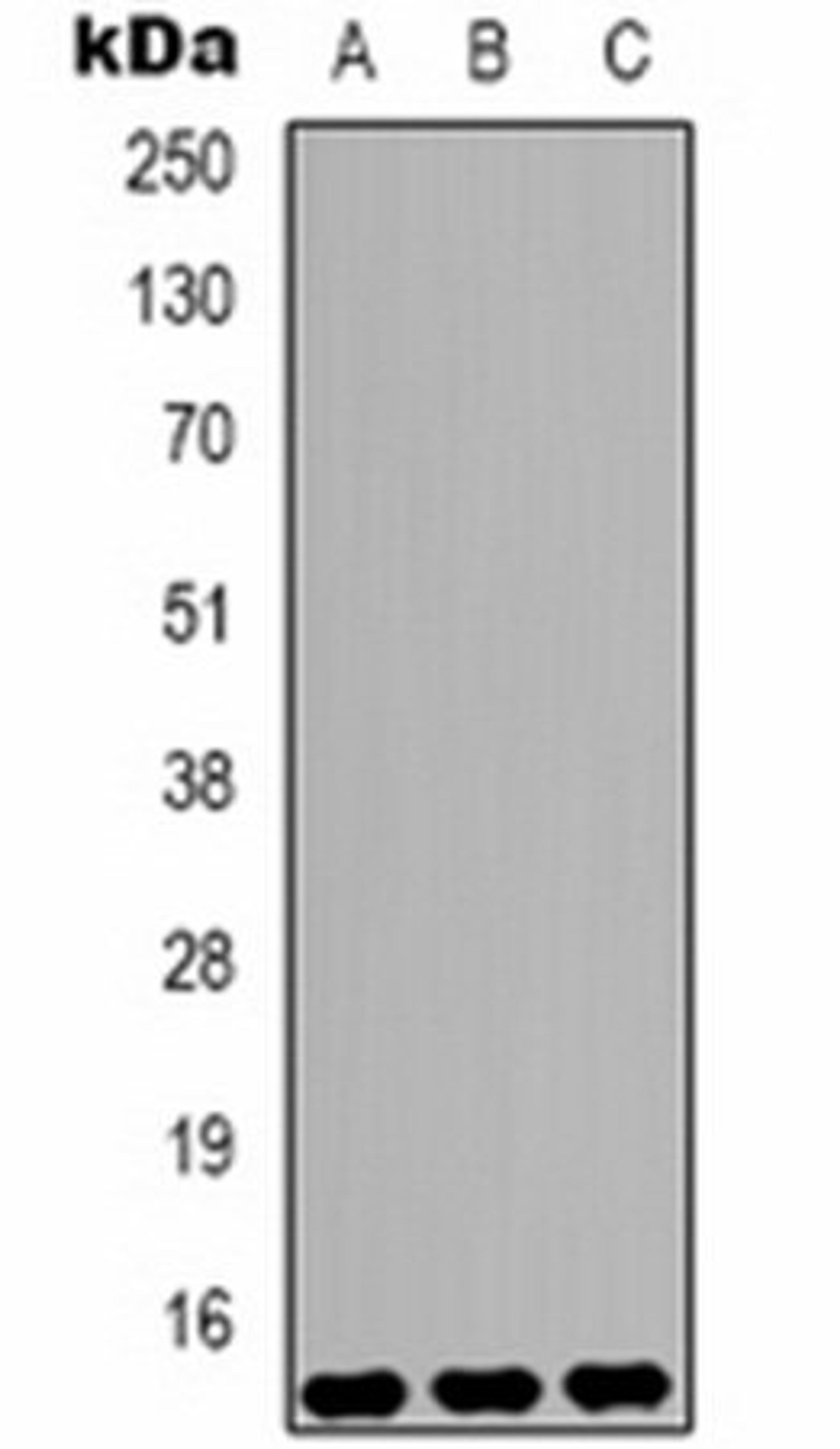 Western blot analysis of Hela (Lane 1), Raw264.7 (Lane 2), rat heart (Lane 3) whole cell lysates using Histone H3 (DiMethyl K9) antibody