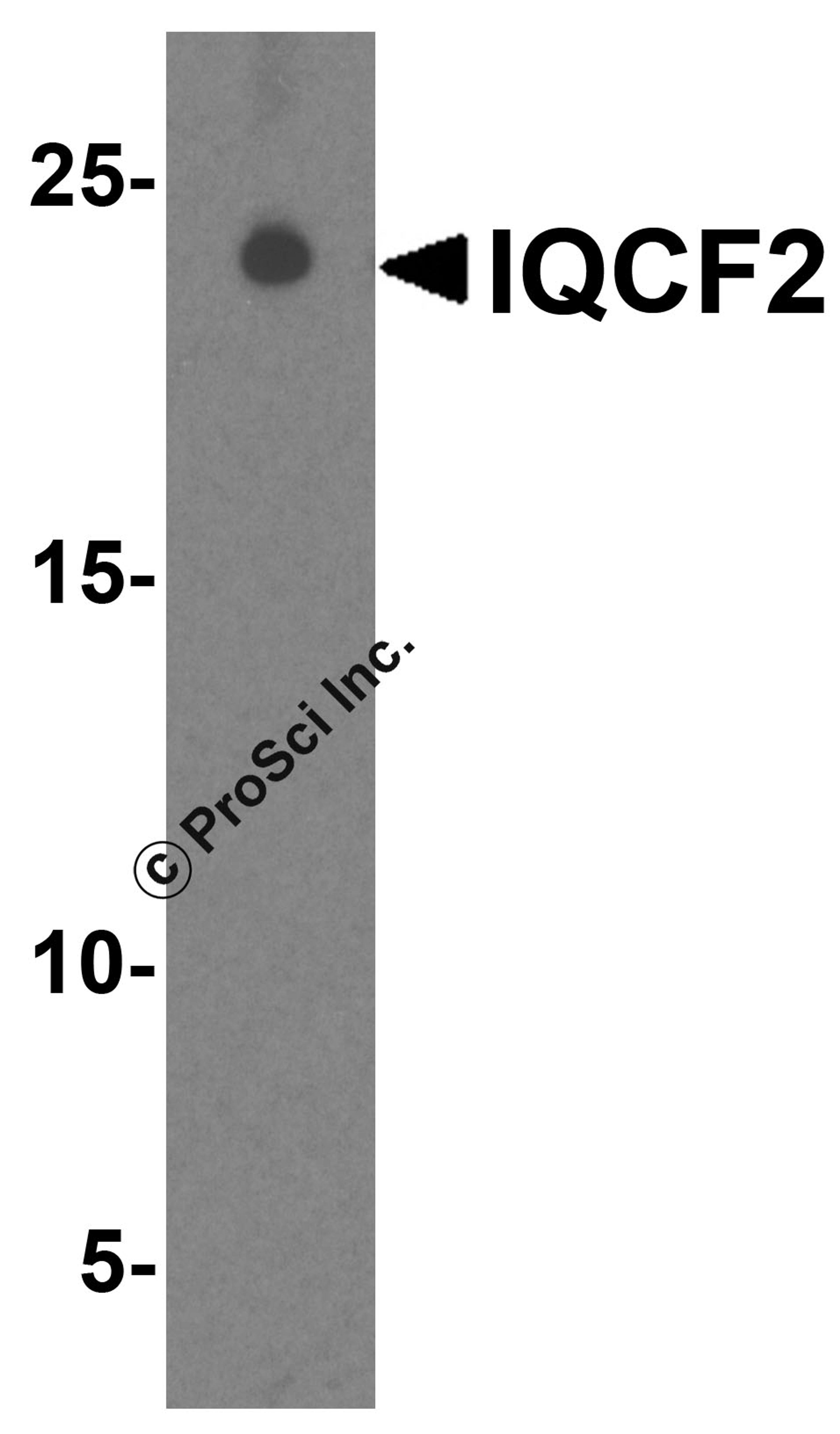 Western blot analysis of IQCF2 in human testis tissue lysate with IQCF2 antibody at 1 μg/ml.