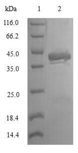 (Tris-Glycine gel) Discontinuous SDS-PAGE (reduced) with 5% enrichment gel and 15% separation gel.