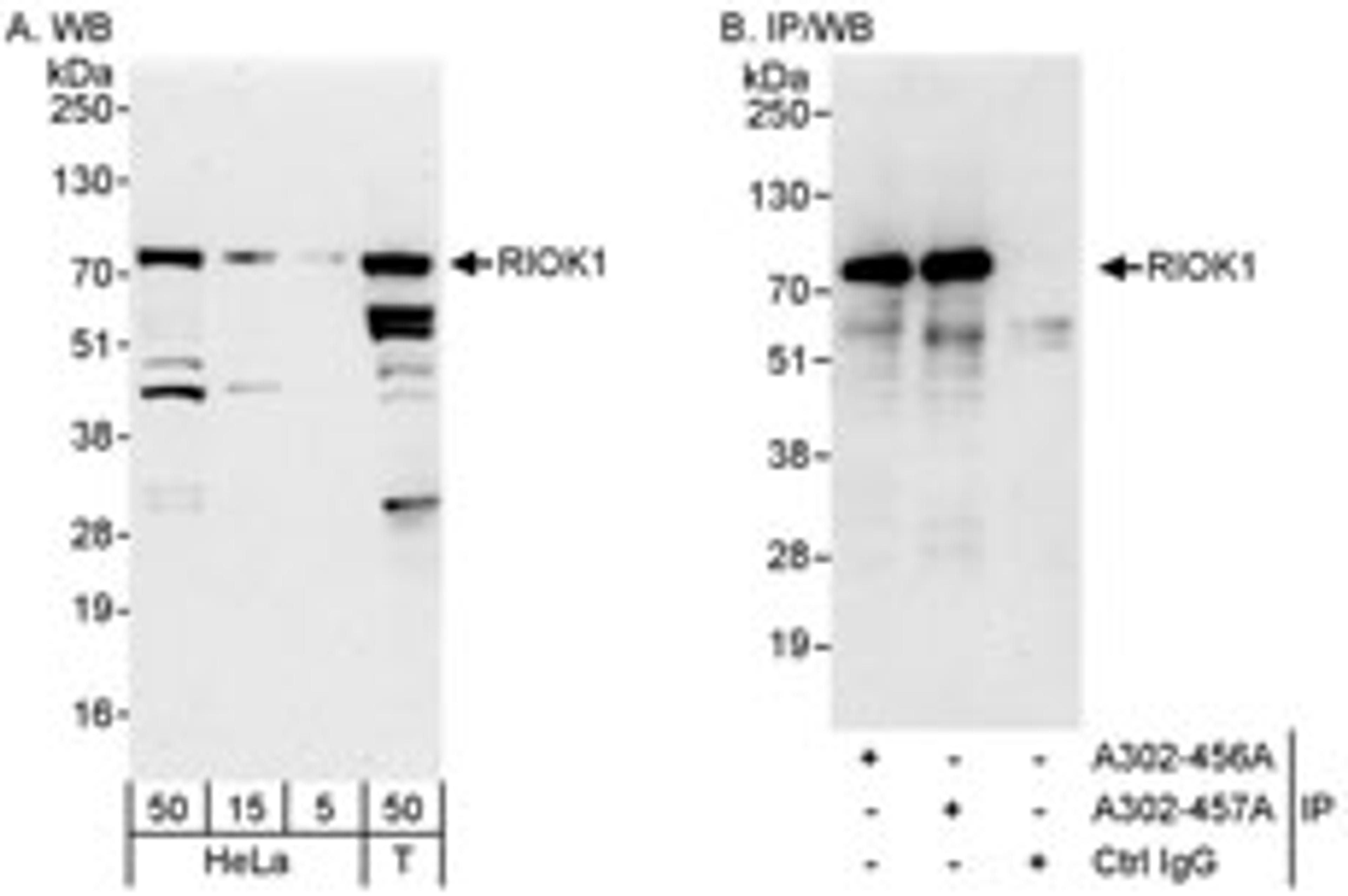 Detection of human RIOK1 by western blot and immunoprecipitation.