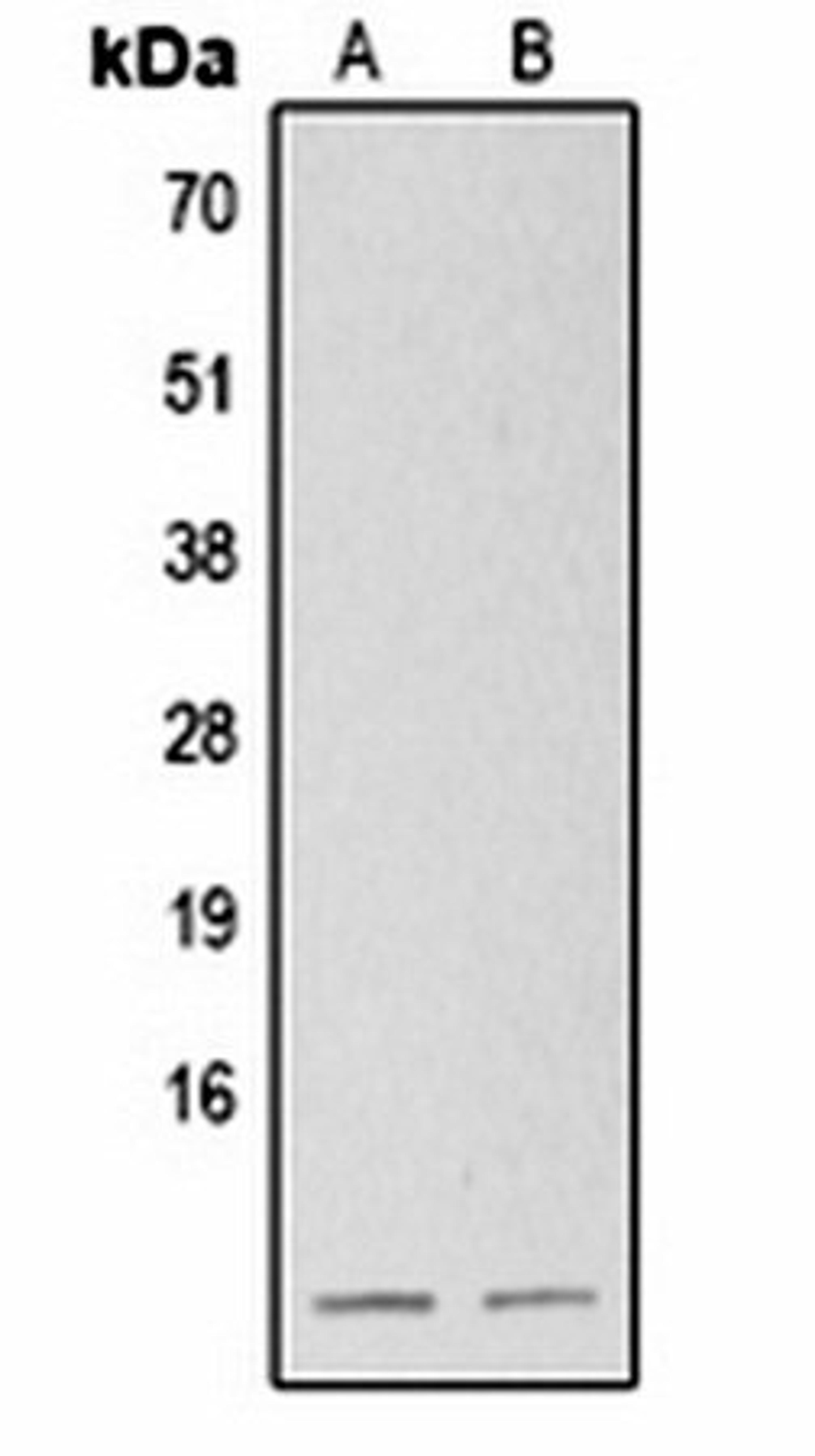 Western blot analysis of  mouse brain (Lane1), rat brain (Lane2) whole cell lysates using S100-B antibody