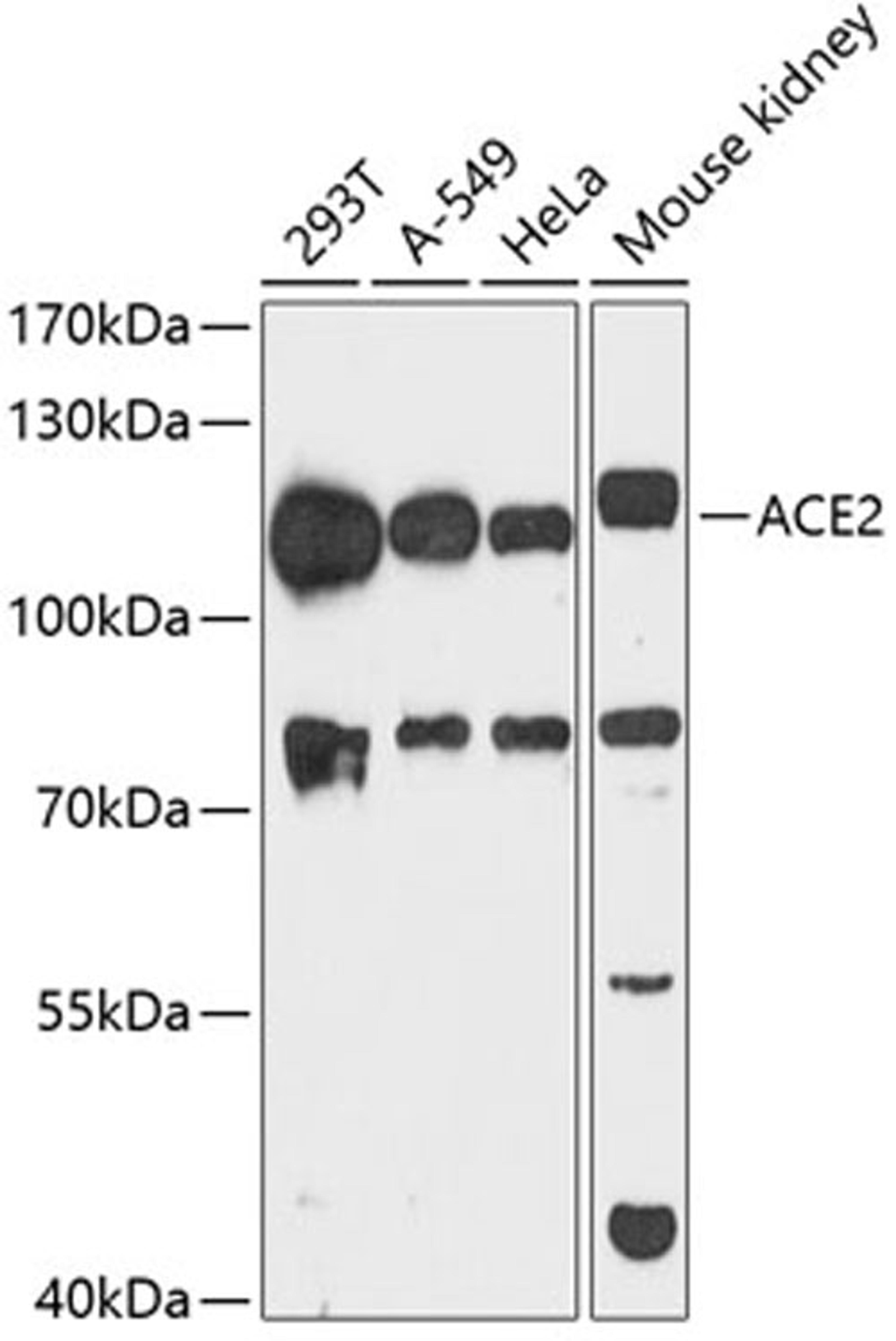 Western blot - ACE2 antibody (A12737)