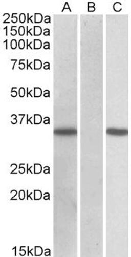 HEK293 lysate (10ug protein in RIPA buffer) overexpressing Human CRISP2 (RC205312) with C-terminal MYC tag probed with orb20488 (1ug/ml) in Lane A and probed with anti-MYC Tag (1/1000) in lane C. Mock-transfected HEK293 probed with orb20468 (1mg/ml) in La