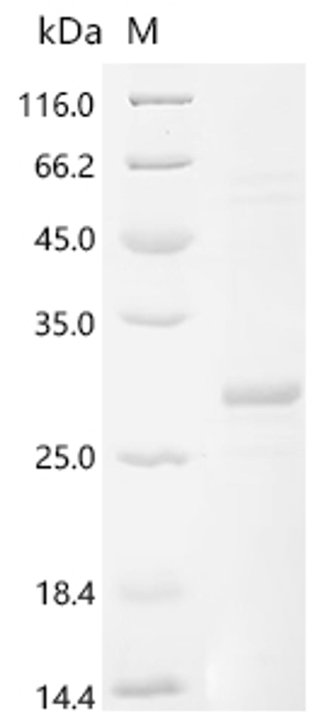 (Tris-Glycine gel) Discontinuous SDS-PAGE (reduced) with 5% enrichment gel and 15% separation gel.