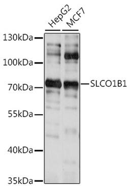 Western blot - SLCO1B1 antibody (A15783)