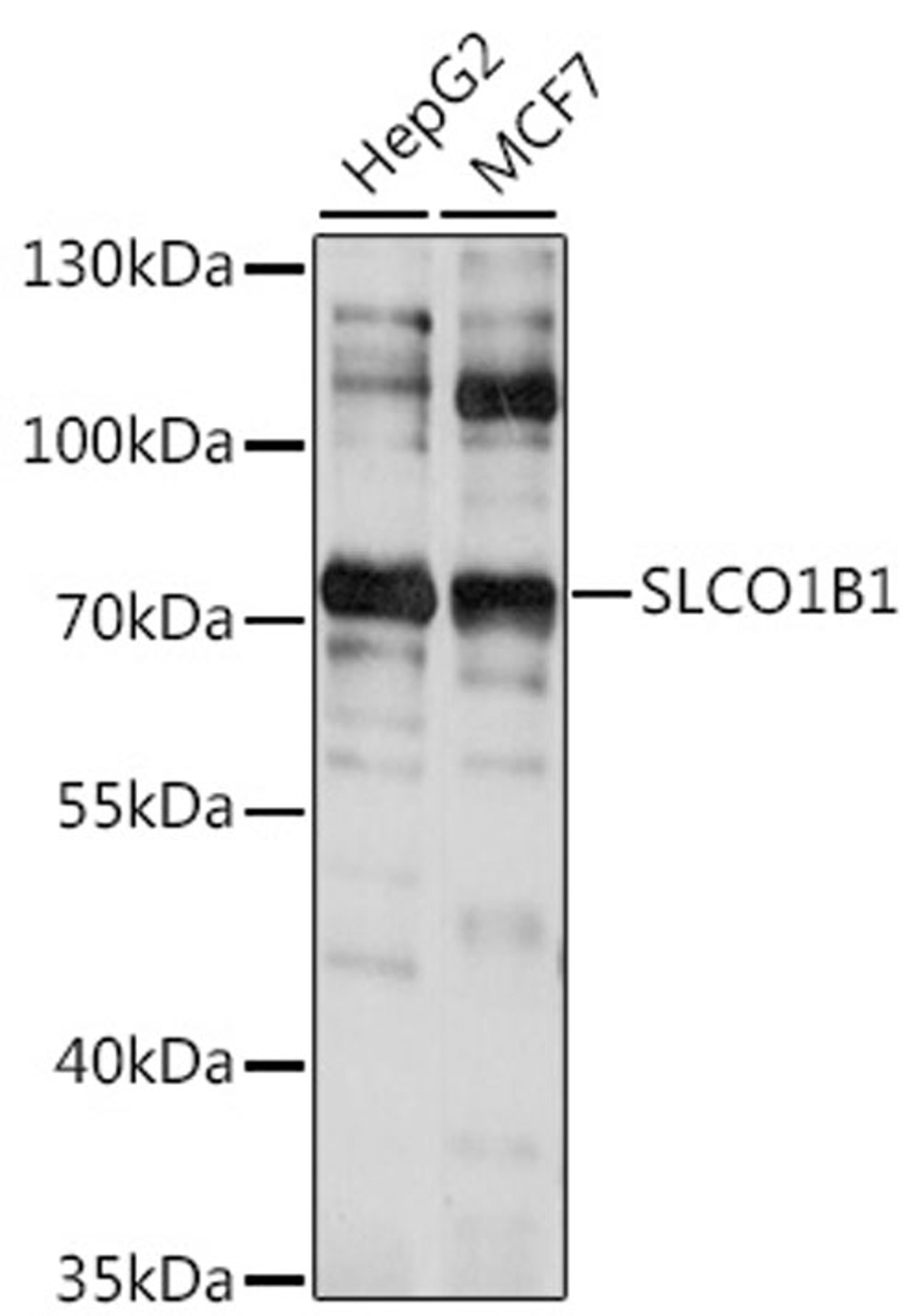 Western blot - SLCO1B1 antibody (A15783)