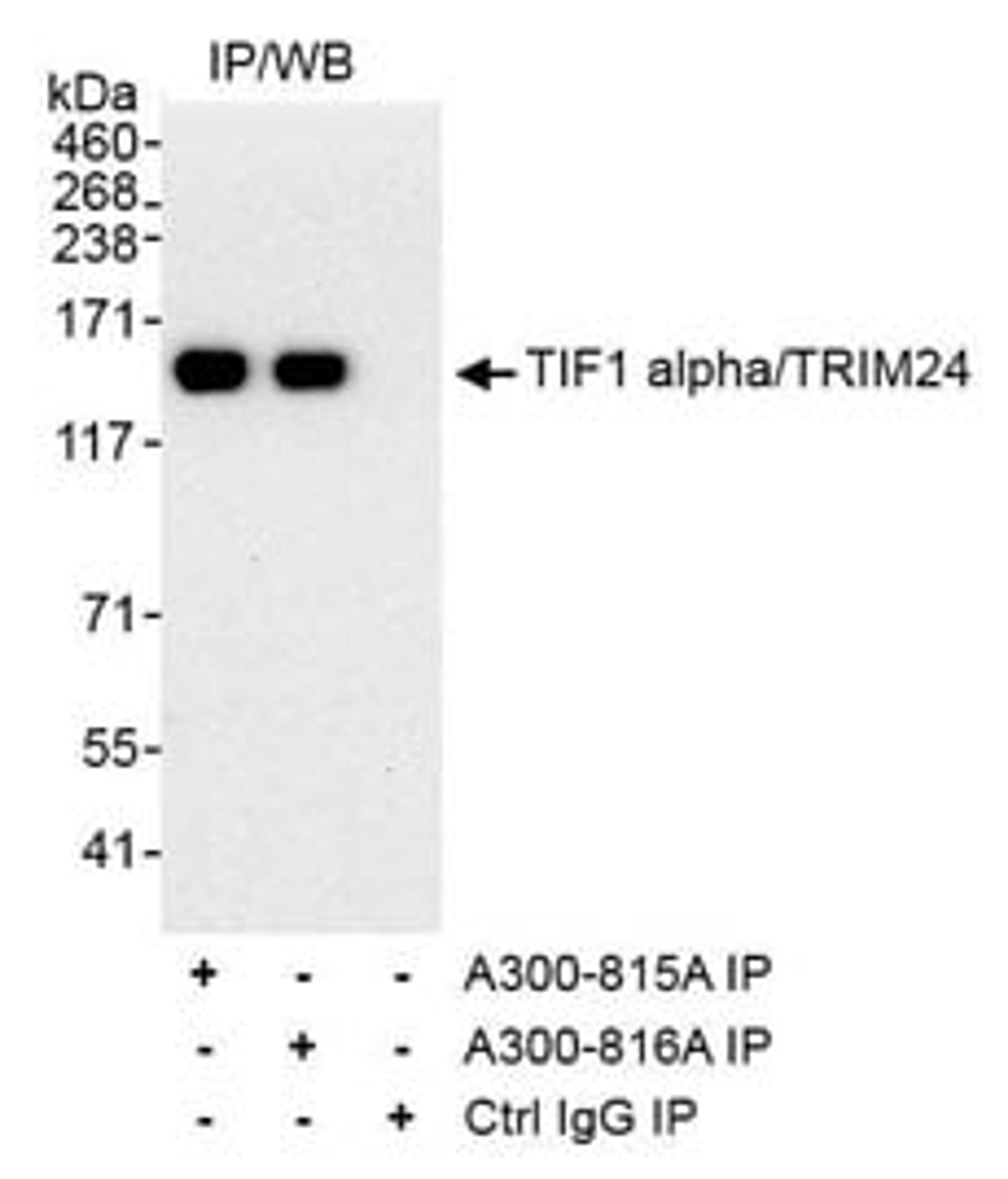 Detection of human TIF1 alpha/TRIM24 by western blot of immunoprecipitates.