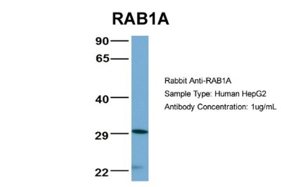 Western Blot: Rab1A Antibody [NBP1-55113] - Analysis of HepG2 cell lysate. Antibody Dilution: 1.0 ug/ml.