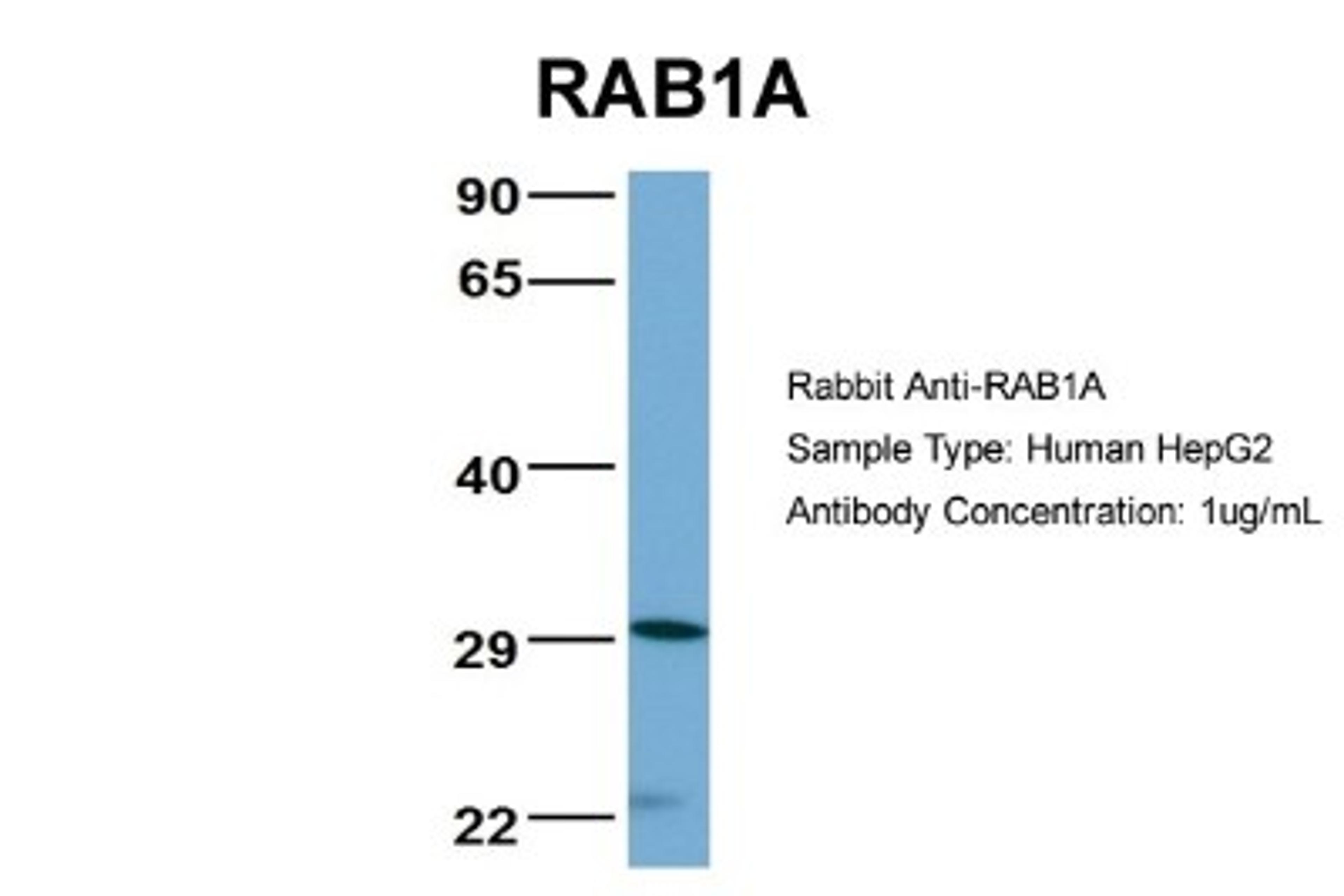 Western Blot: Rab1A Antibody [NBP1-55113] - Analysis of HepG2 cell lysate. Antibody Dilution: 1.0 ug/ml.