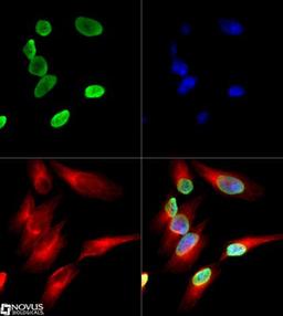 Immunocytochemistry/Immunofluorescence: Histone H4 [ac Lys12] Antibody [NB21-2064] - Histone H4 [ac Lys12] antibody was tested at 1:10 in HeLa cells with Dylight 488 (green). Nuclei and alpha-tubulin were counterstained with DAPI (blue) and Dylight 550 (red). Image objective 40x.