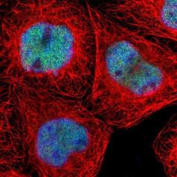 Immunocytochemistry/Immunofluorescence: ZNF680 Antibody [NBP1-81878] - Staining of human cell line A-431 shows positivity in nuclei but not nucleoli.