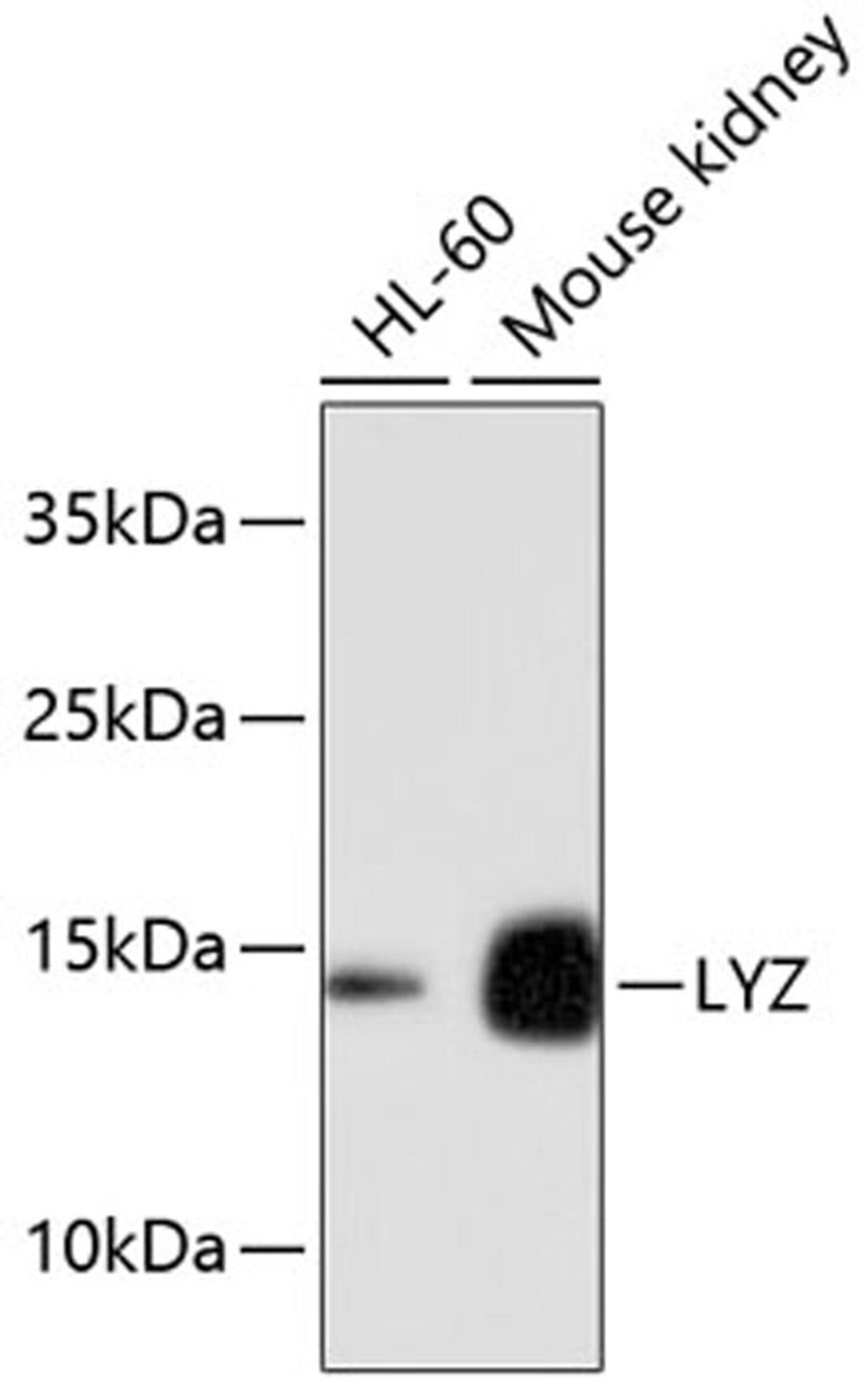 Western blot - LYZ antibody (A10972)