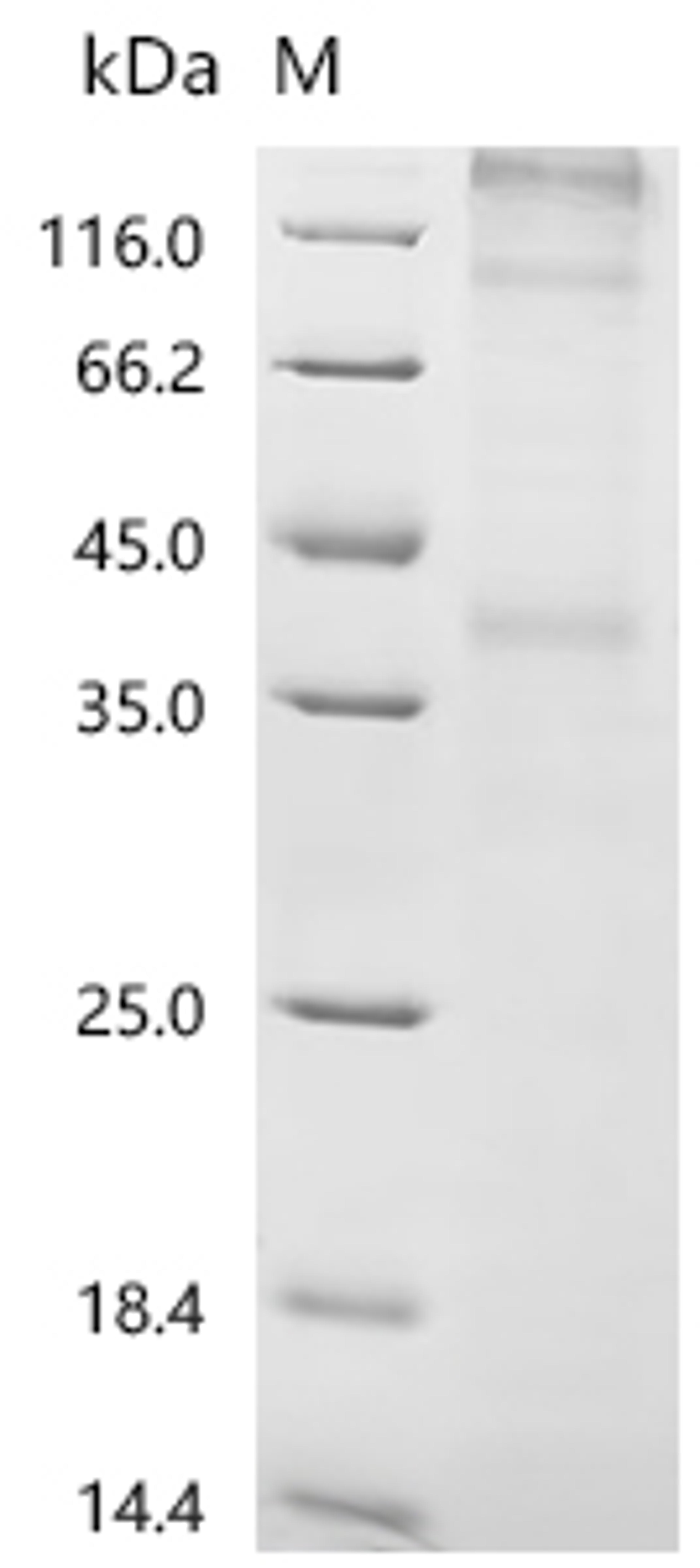 (Tris-Glycine gel) Discontinuous SDS-PAGE (reduced) with 5% enrichment gel and 15% separation gel.