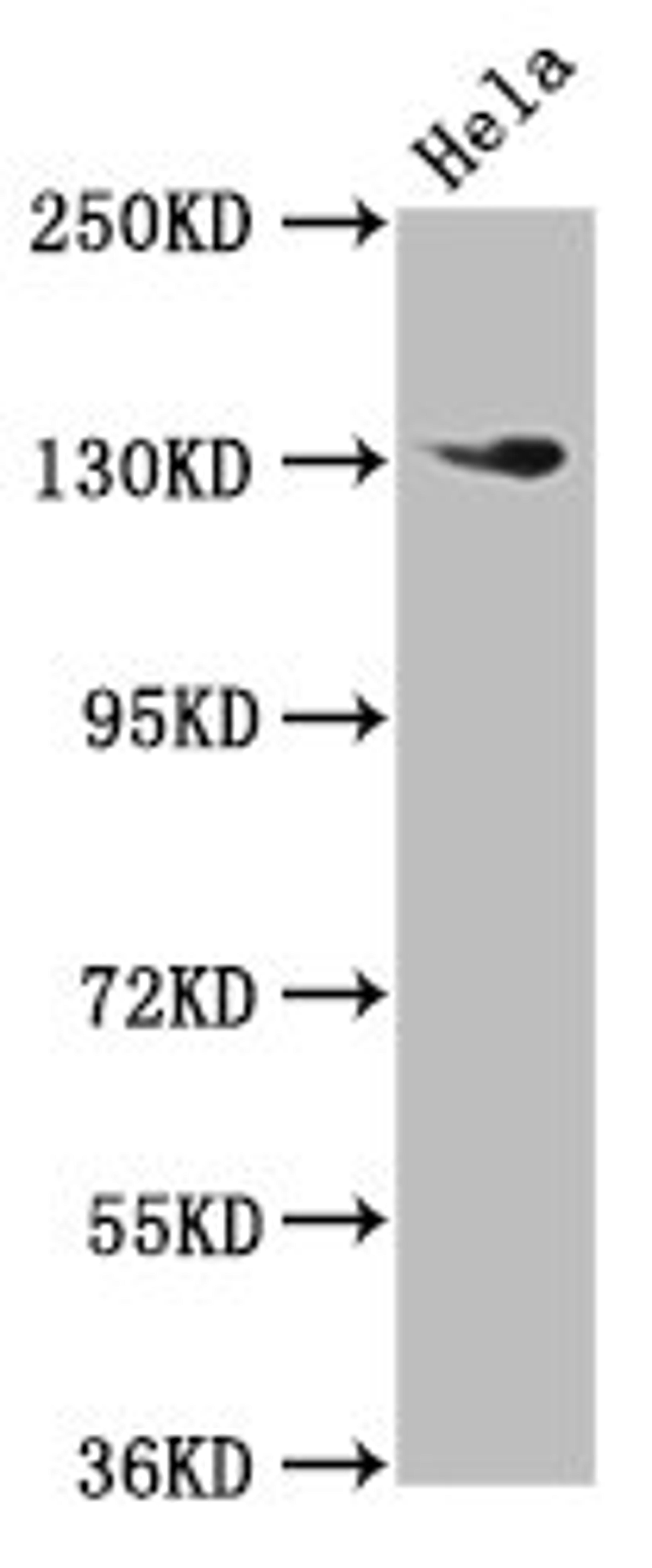 Western Blot. Positive WB detected in: Hela whole cell lysate. All lanes: NOMO1 antibody at 3µg/ml. Secondary. Goat polyclonal to rabbit IgG at 1/50000 dilution. Predicted band size: 135 kDa. Observed band size: 135 kDa