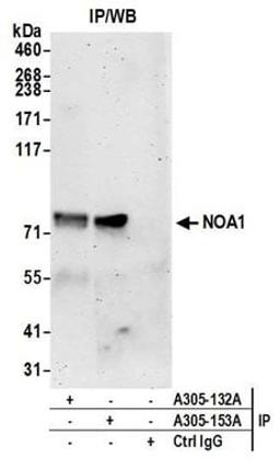 Detection of human NOA1 by western blot of immunoprecipitates.