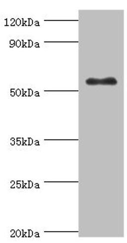 Western blot. All lanes: Glucokinase antibody at 8ug/ml + HepG2 whole cell lysate. Secondary. Goat polyclonal to rabbit IgG at 1/10000 dilution. Predicted band size: 52 kDa. Observed band size: 52 kDa. 