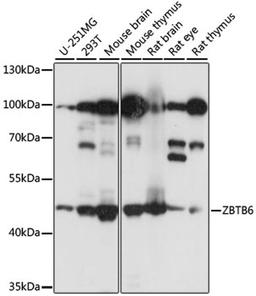 Western blot - ZBTB6 antibody (A15136)