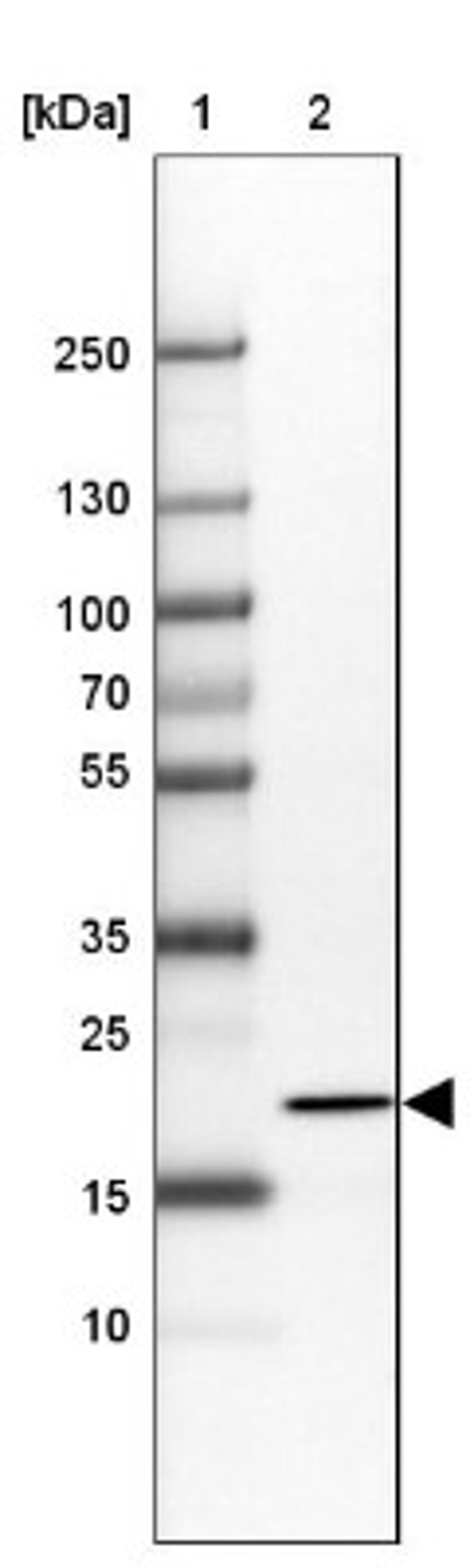 Western Blot: VPS29 Antibody [NBP1-85288] - Lane 1: Marker [kDa] 250, 130, 100, 70, 55, 35, 25, 15, 10<br/>Lane 2: RT-4