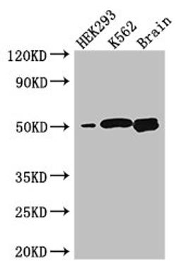 Western Blot. Positive WB detected in: HEK293 whole cell lysate, K562 whole cell lysate, Mouse brain tissue. All lanes: BTNL2 antibody at 3.2µg/ml. Secondary. Goat polyclonal to rabbit IgG at 1/50000 dilution. Predicted band size: 51, 44, 31, 28, 20, 29 kDa. Observed band size: 51 kDa