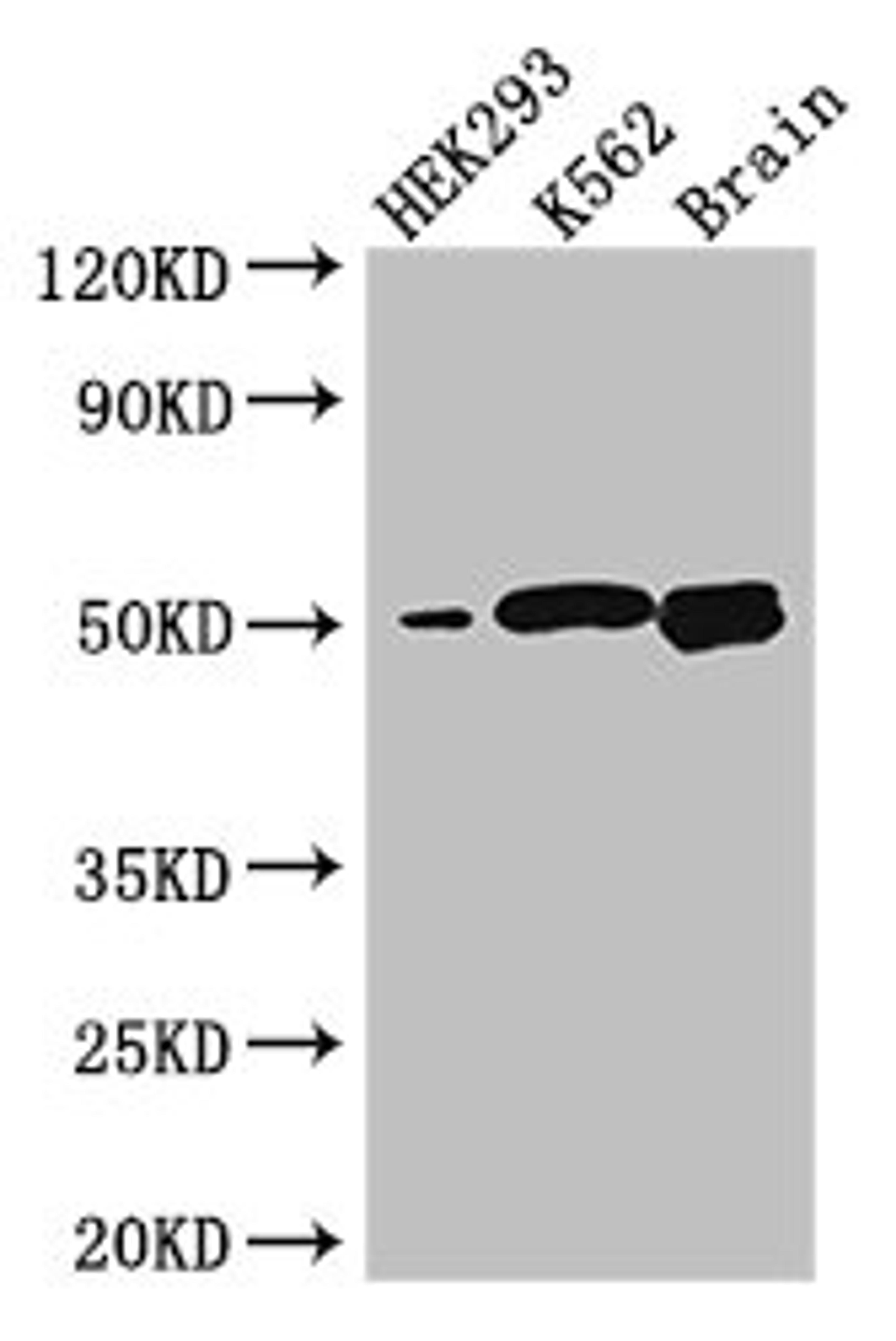 Western Blot. Positive WB detected in: HEK293 whole cell lysate, K562 whole cell lysate, Mouse brain tissue. All lanes: BTNL2 antibody at 3.2µg/ml. Secondary. Goat polyclonal to rabbit IgG at 1/50000 dilution. Predicted band size: 51, 44, 31, 28, 20, 29 kDa. Observed band size: 51 kDa