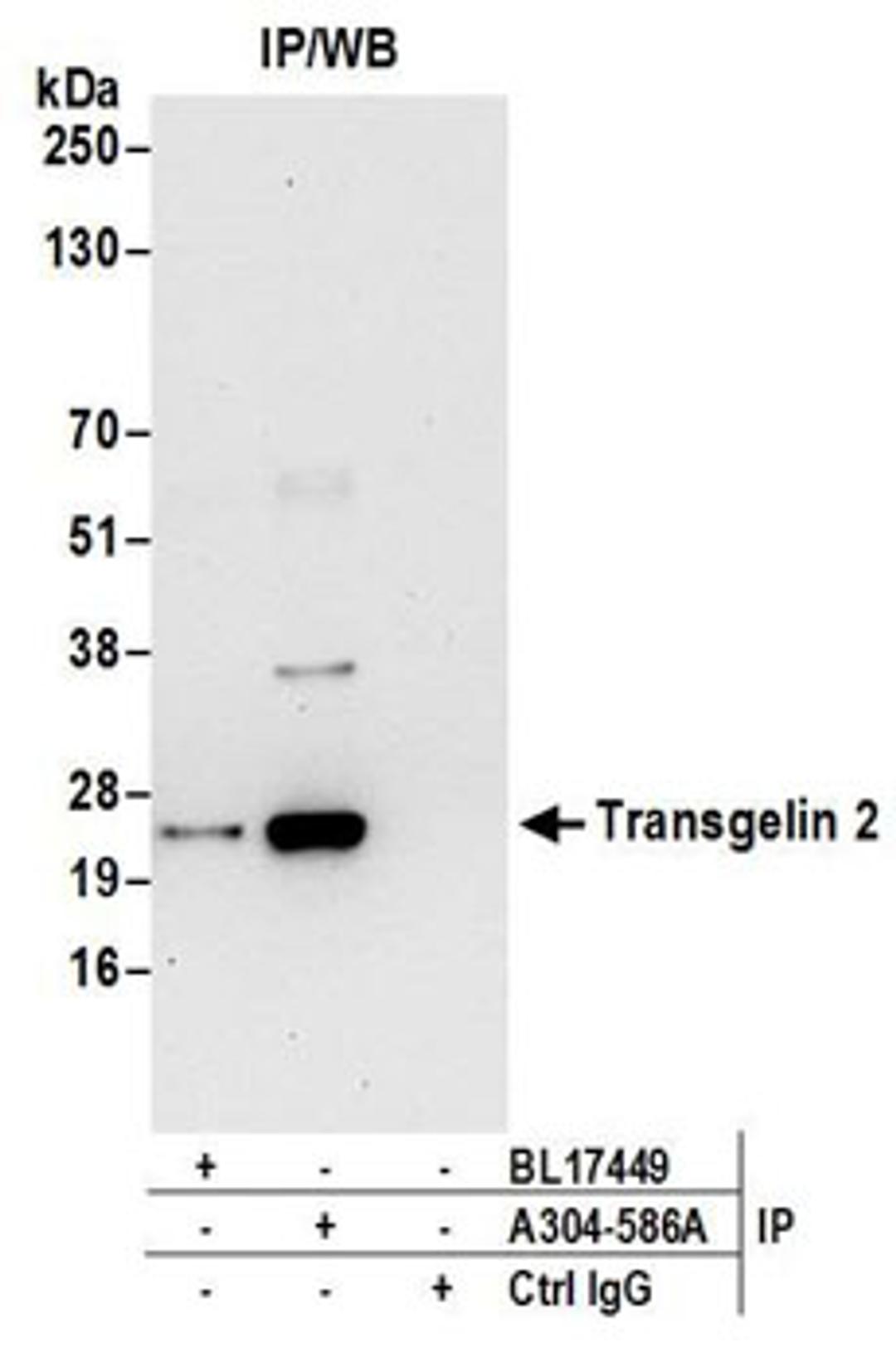 Detection of human Transgelin 2 by western blot of immunoprecipitates.