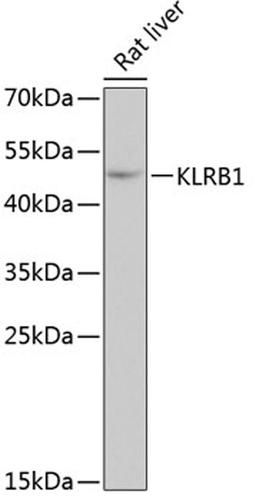 Western blot - KLRB1 antibody (A6928)