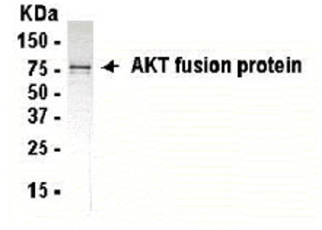 Western Blot: XW-7019 dilution: 1:2,000. Goat anti-13990-HRP dilution: 1:1,000. E coli-derived fusion protein as test antigen.