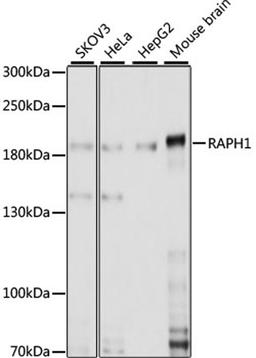 Western blot - RAPH1 antibody (A15506)