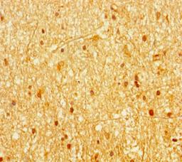 Immunohistochemistry of paraffin-embedded human brain tissue using CSB-PA001481LA01HU at dilution of 1:100