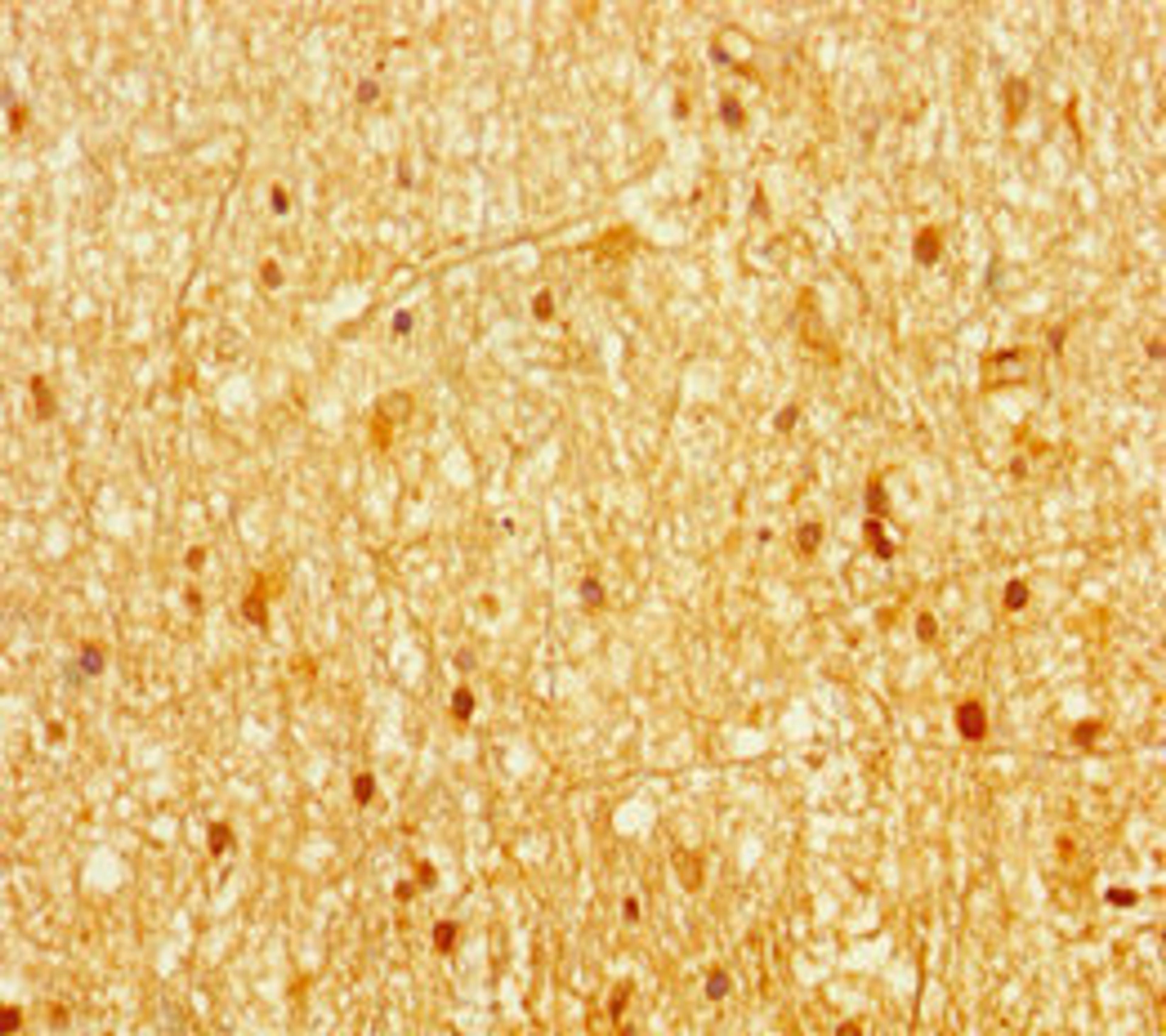 Immunohistochemistry of paraffin-embedded human brain tissue using CSB-PA001481LA01HU at dilution of 1:100